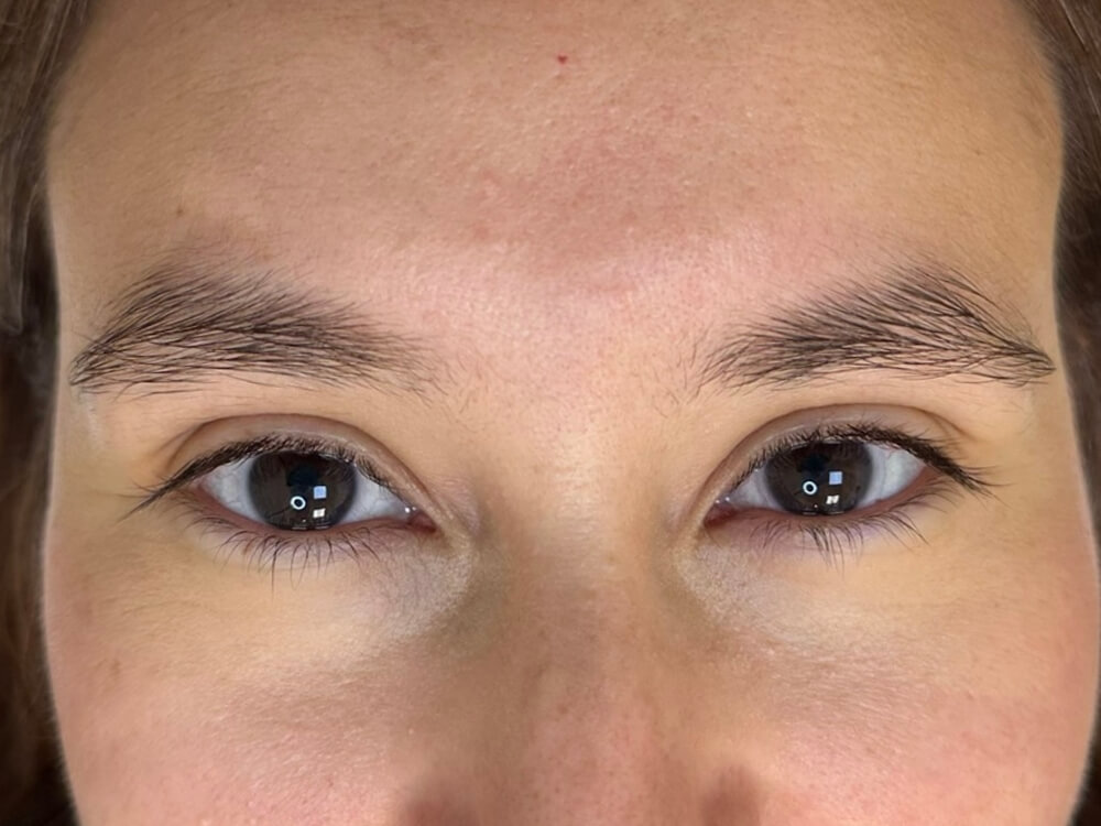 Cejas antes del nanoblading realizado en Genéh